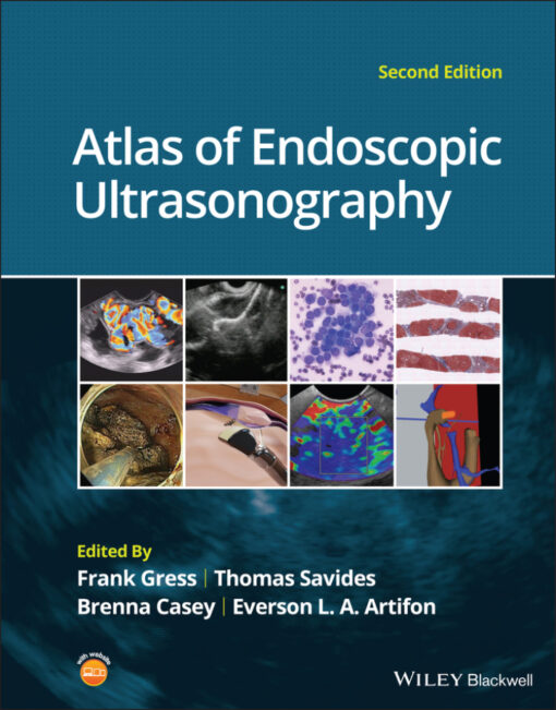 Atlas Of Endoscopic Ultrasonography 2nd Edition