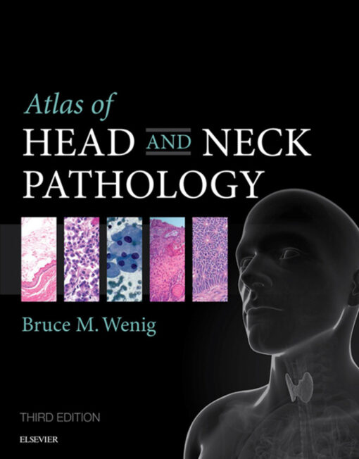 Atlas Of Head And Neck Pathology 3rd Edition