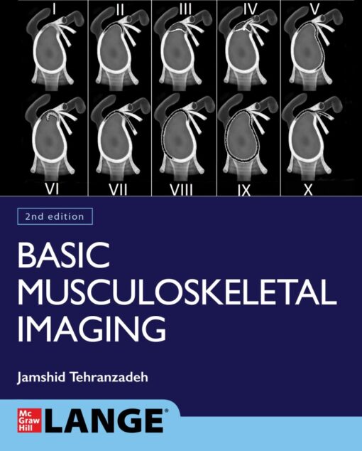 Basic Musculoskeletal Imaging Second Edition