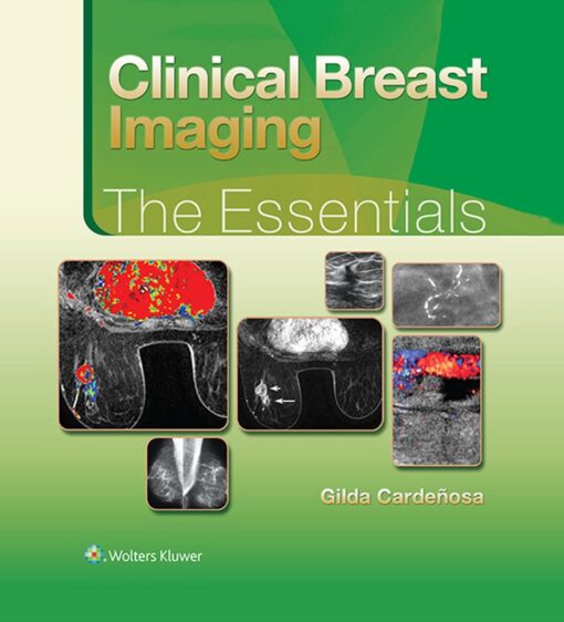 Clinical Breast Imaging The Essentials