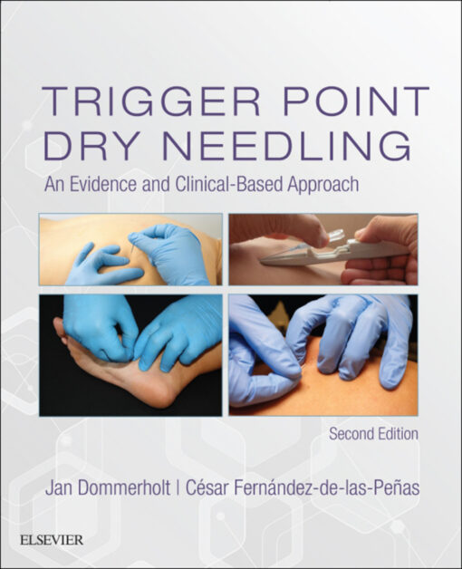 Trigger Point Dry Needling An Evidence And Clinical Based Approach 2nd Edition