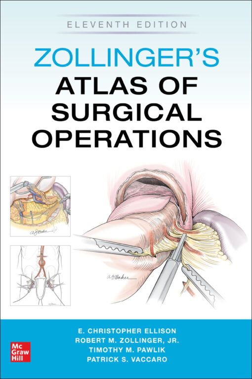 Zollingers Atlas Of Surgical Operations 11th Edition